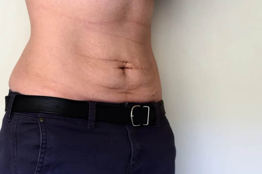 Jak poprawić sylwetkę: skuteczne metody na wymarzoną figurę Jak poprawić sylwetkę: skuteczne metody na wymarzoną figurę